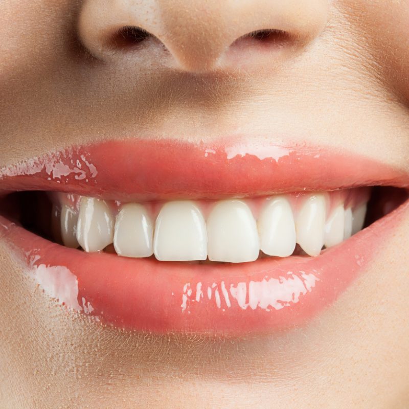 white teeth from oil pulling